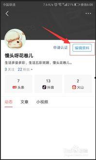 今日头条换名字后